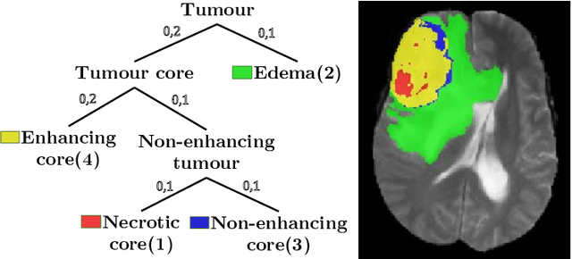 Figure 1 for Generalised Wasserstein Dice Score for Imbalanced Multi-class Segmentation using Holistic Convolutional Networks