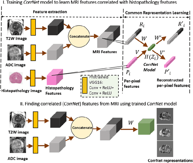 Figure 1 for CorrSigNet: Learning CORRelated Prostate Cancer SIGnatures from Radiology and Pathology Images for Improved Computer Aided Diagnosis