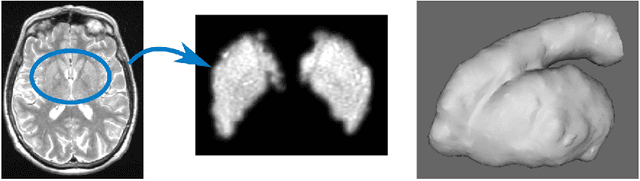 Figure 3 for 3D Regression Neural Network for the Quantification of Enlarged Perivascular Spaces in Brain MRI