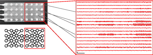 Figure 1 for Modeling the Complex Dynamics and Changing Correlations of Epileptic Events