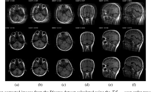 Figure 4 for A Novel Approach for Correcting Multiple Discrete Rigid In-Plane Motions Artefacts in MRI Scans