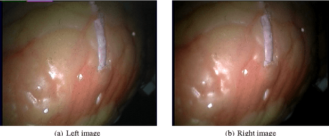 Figure 1 for Automatic 3D Point Set Reconstruction from Stereo Laparoscopic Images using Deep Neural Networks
