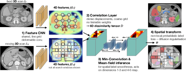 Figure 1 for Closing the Gap between Deep and Conventional Image Registration using Probabilistic Dense Displacement Networks