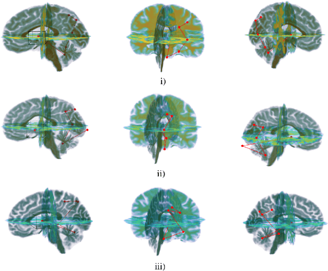 Figure 4 for NEURO-DRAM: a 3D recurrent visual attention model for interpretable neuroimaging classification