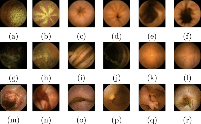Figure 1 for Generic Feature Learning for Wireless Capsule Endoscopy Analysis