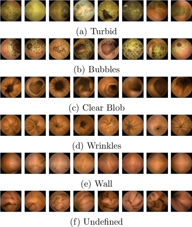 Figure 3 for Generic Feature Learning for Wireless Capsule Endoscopy Analysis