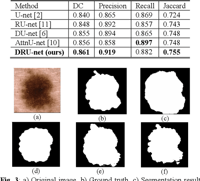Figure 4 for DRU-net: An Efficient Deep Convolutional Neural Network for Medical Image Segmentation