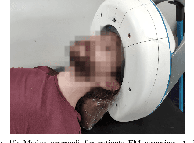 Figure 2 for Operational Learning-based Boundary Estimation in Electromagnetic Medical Imaging