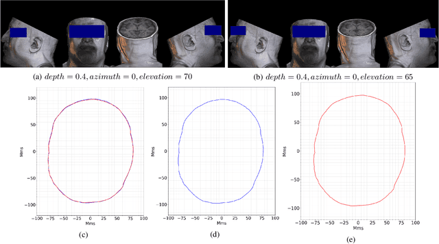 Figure 3 for Operational Learning-based Boundary Estimation in Electromagnetic Medical Imaging