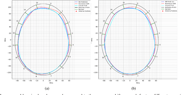 Figure 4 for Operational Learning-based Boundary Estimation in Electromagnetic Medical Imaging