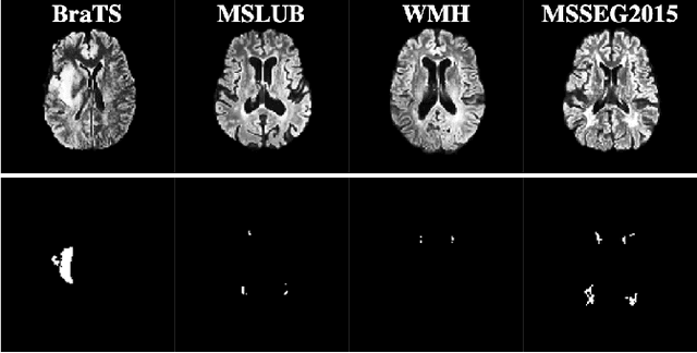 Figure 3 for Challenging Current Semi-Supervised Anomaly Segmentation Methods for Brain MRI