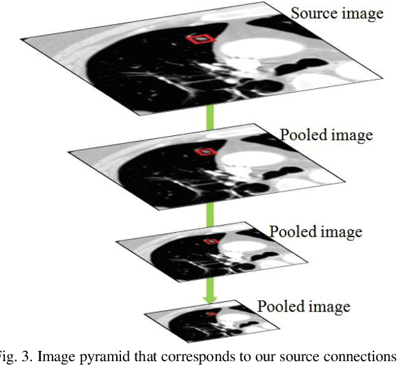 Figure 4 for PiaNet: A pyramid input augmented convolutional neural network for GGO detection in 3D lung CT scans