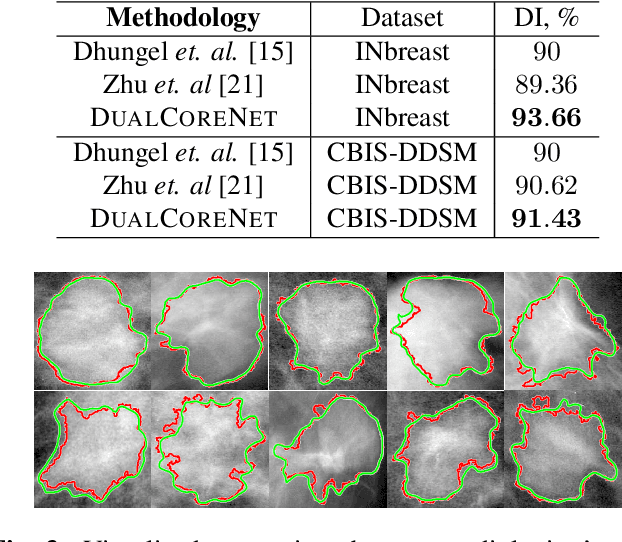 Figure 3 for A Deep DUAL-PATH Network for Improved Mammogram Image Processing