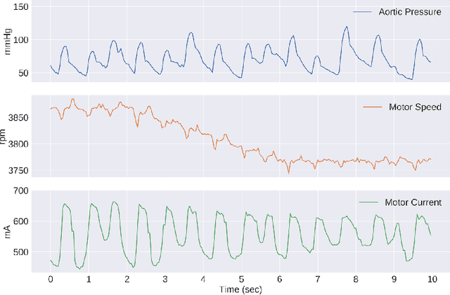 Figure 3 for Aortic Pressure Forecasting with Deep Sequence Learning
