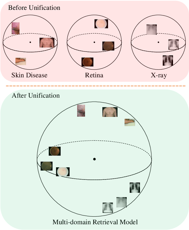 Figure 1 for Universal Model for Multi-Domain Medical Image Retrieval