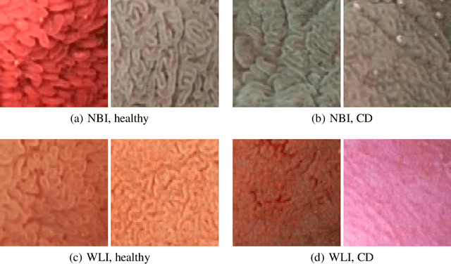 Figure 1 for Improving Endoscopic Decision Support Systems by Translating Between Imaging Modalities