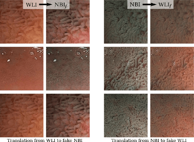 Figure 3 for Improving Endoscopic Decision Support Systems by Translating Between Imaging Modalities