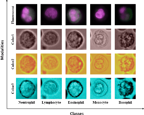 Figure 1 for Leukocyte Classification using Multimodal Architecture Enhanced by Knowledge Distillation