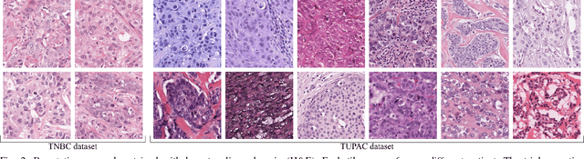 Figure 2 for Whole-Slide Mitosis Detection in H&E Breast Histology Using PHH3 as a Reference to Train Distilled Stain-Invariant Convolutional Networks