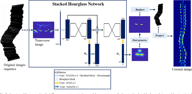 Figure 4 for Automatic segmentation of vertebral features on ultrasound spine images using Stacked Hourglass Network