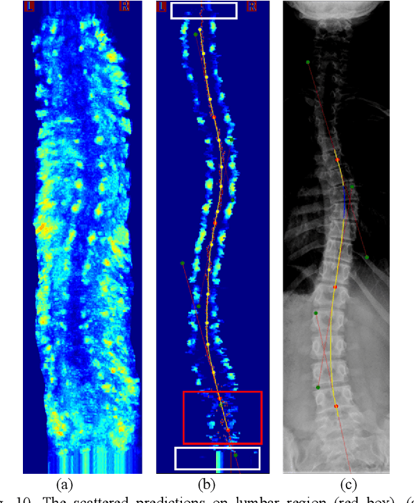 Figure 2 for Automatic segmentation of vertebral features on ultrasound spine images using Stacked Hourglass Network