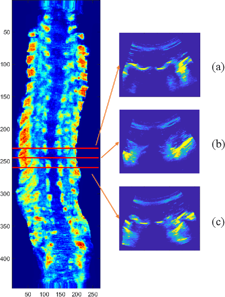 Figure 3 for Automatic segmentation of vertebral features on ultrasound spine images using Stacked Hourglass Network