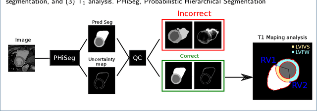 Figure 1 for Automated quantification of myocardial tissue characteristics from native T1 mapping using neural networks with Bayesian inference for uncertainty-based quality-control