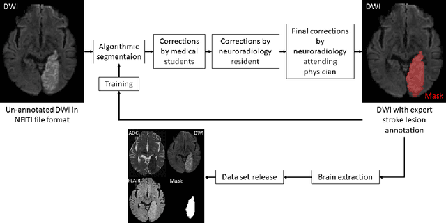 Figure 4 for ISLES 2022: A multi-center magnetic resonance imaging stroke lesion segmentation dataset