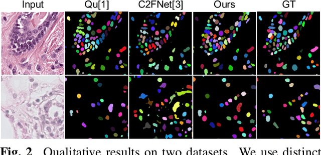 Figure 3 for Weakly Supervised Nuclei Segmentation via Instance Learning