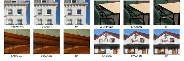 Figure 3 for Super Resolution Using Segmentation-Prior Self-Attention Generative Adversarial Network