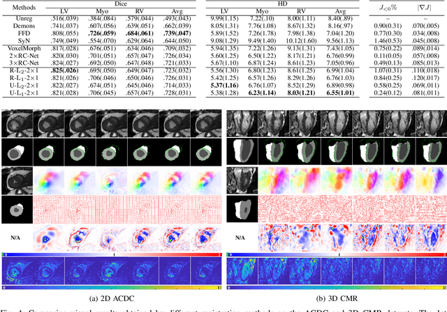 Figure 4 for Learning a Model-Driven Variational Network for Deformable Image Registration