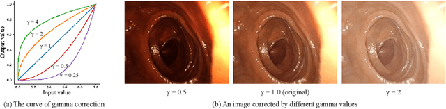 Figure 3 for Lighting Enhancement Aids Reconstruction of Colonoscopic Surfaces