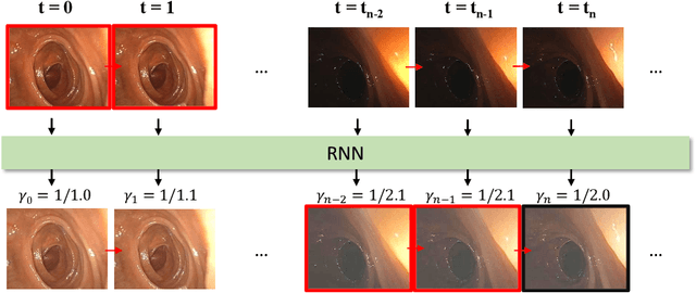 Figure 4 for Lighting Enhancement Aids Reconstruction of Colonoscopic Surfaces