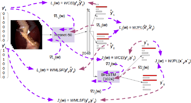 Figure 3 for Multitask Learning of Temporal Connectionism in Convolutional Networks using a Joint Distribution Loss Function to Simultaneously Identify Tools and Phase in Surgical Videos