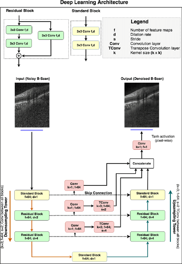 Figure 1 for A Deep Learning Approach to Denoise Optical Coherence Tomography Images of the Optic Nerve Head