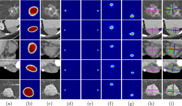 Figure 4 for Semi-Automatic RECIST Labeling on CT Scans with Cascaded Convolutional Neural Networks