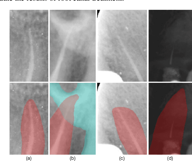 Figure 1 for Anatomy-Guided Parallel Bottleneck Transformer Network for Automated Evaluation of Root Canal Therapy