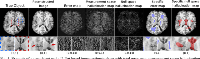 Figure 1 for On hallucinations in tomographic image reconstruction