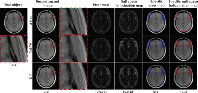Figure 2 for On hallucinations in tomographic image reconstruction