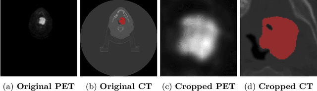 Figure 3 for TMSS: An End-to-End Transformer-based Multimodal Network for Segmentation and Survival Prediction