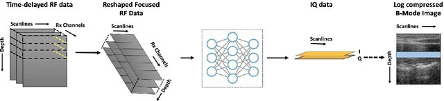 Figure 3 for Adaptive and Compressive Beamforming using Deep Learning for Medical Ultrasound