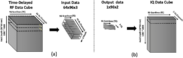Figure 4 for Adaptive and Compressive Beamforming using Deep Learning for Medical Ultrasound