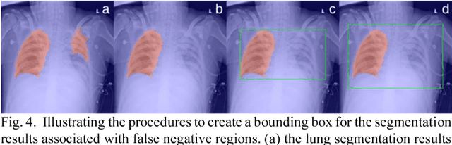 Figure 4 for SDFN: Segmentation-based Deep Fusion Network for Thoracic Disease Classification in Chest X-ray Images