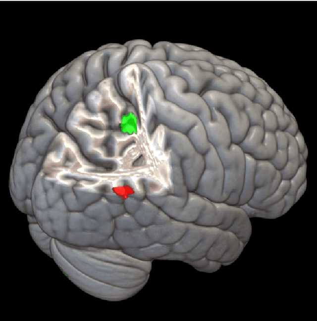Figure 2 for Nonlinear functional mapping of the human brain