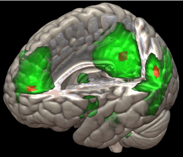 Figure 1 for Nonlinear functional mapping of the human brain