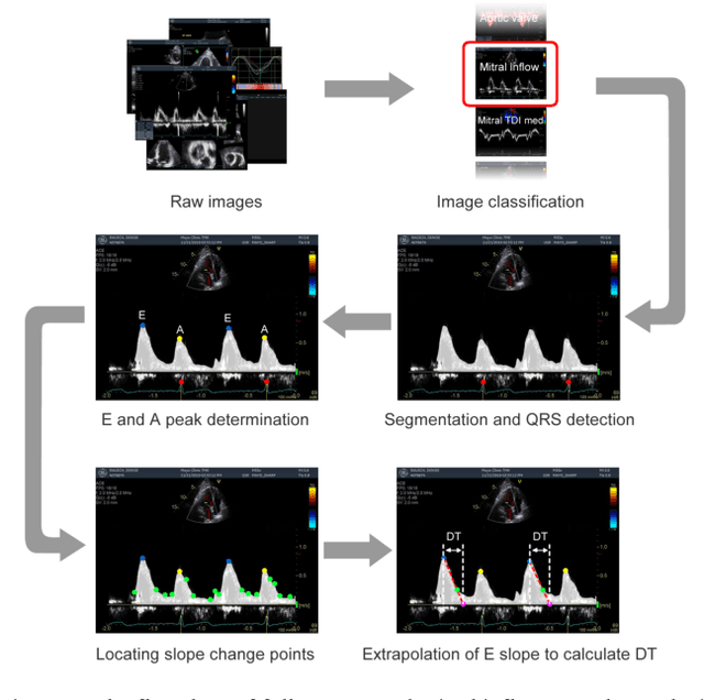 Figure 1 for Fully Automated Mitral Inflow Doppler Analysis Using Deep Learning