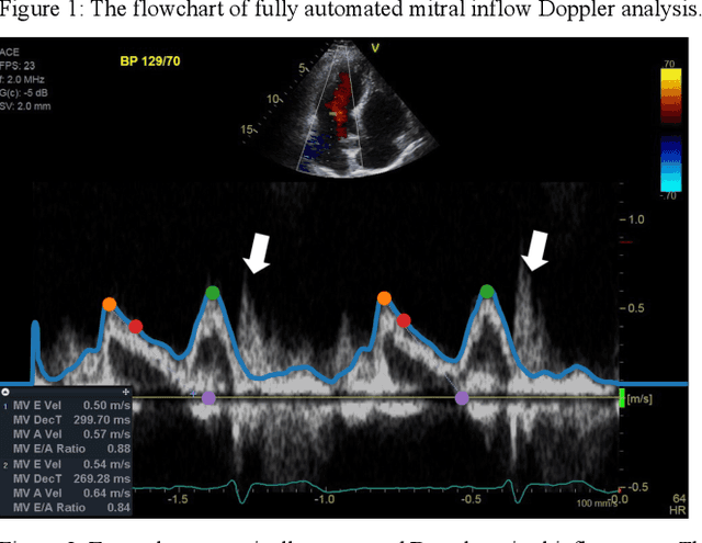 Figure 3 for Fully Automated Mitral Inflow Doppler Analysis Using Deep Learning