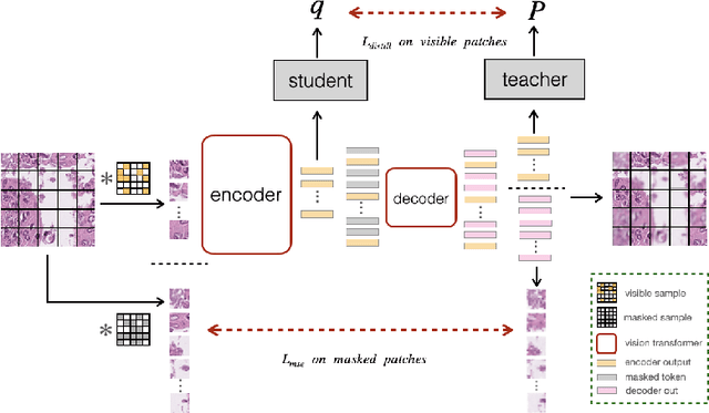 Figure 1 for Self-distillation Augmented Masked Autoencoders for Histopathological Image Classification