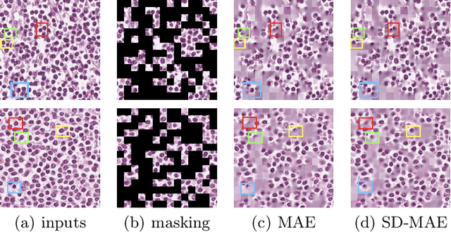 Figure 4 for Self-distillation Augmented Masked Autoencoders for Histopathological Image Classification