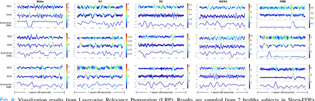 Figure 4 for MetaSleepLearner: Fast Adaptation of Bio-signals-Based Sleep Stage Classifier to New Individual Subject Using Meta-Learning